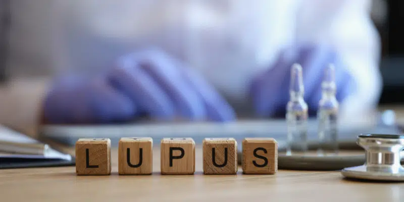 Lupus blog